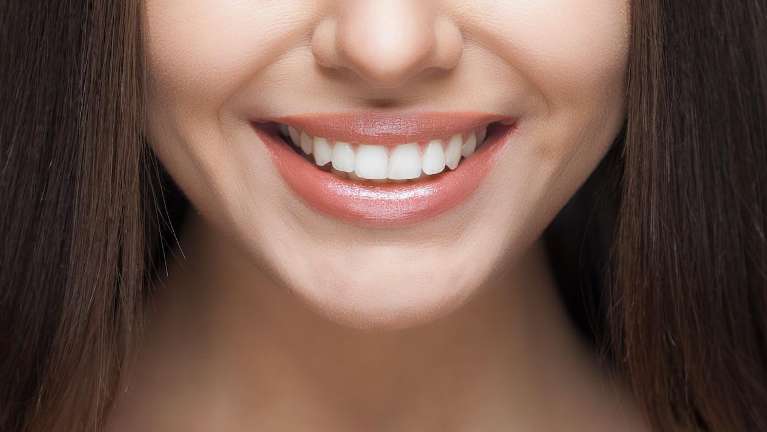 woman smiling | invisalign 11201